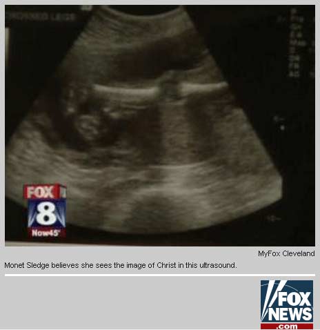 Pregnant Woman Sees Jesus Image in Ultrasound