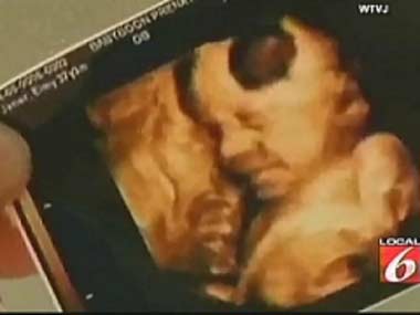 Pregnant Woman Sees Jesus Image in Ultrasound