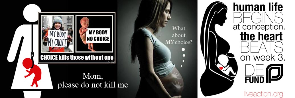 abortion kills