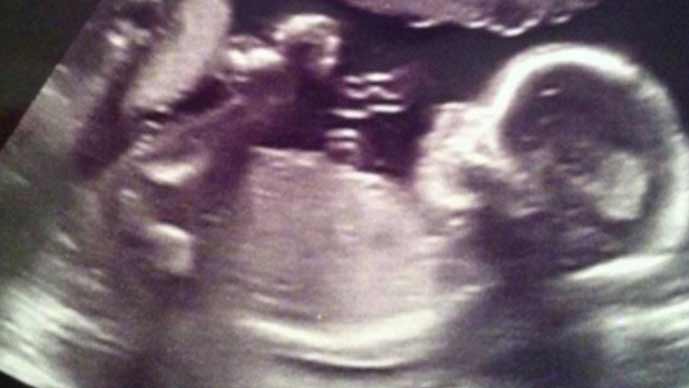 Angels watching over unborn baby in sonograms